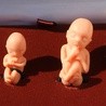 Szef watykańskiej dyplomacji: aborcja nie jest „prawem człowieka”